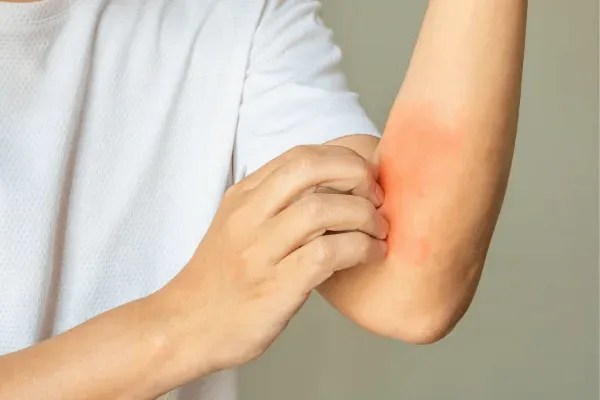 critter stop ant 5 png