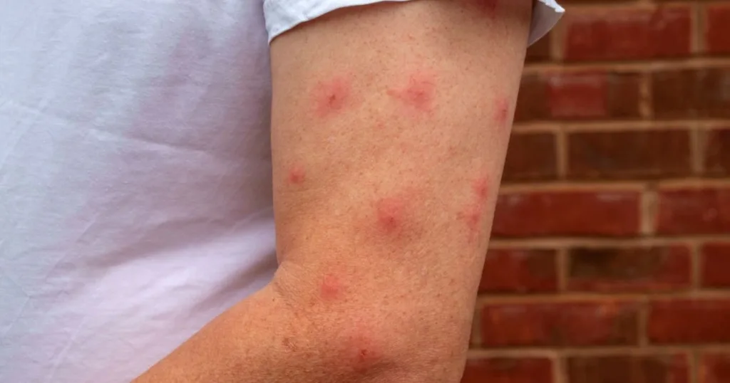 do termites bite