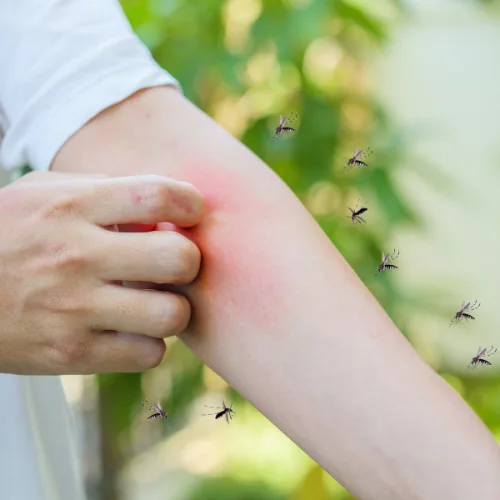 Mosquito Control Arlington